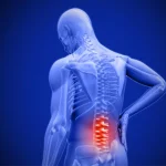 Lower Back Pain: Causes, Relief, and When to See a Doctor